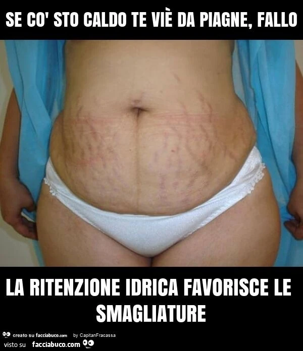 Se cò sto caldo te viè da piagne, fallo la ritenzione idrica favorisce le smagliature