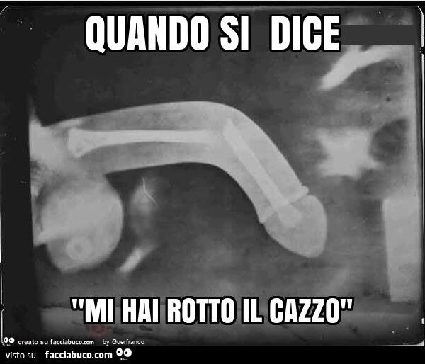 Quando si dice "mi hai rotto il cazzo"
