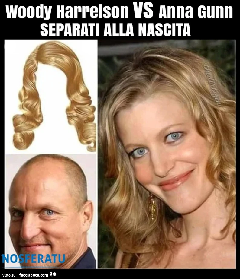 Woody Harrelson, Anna Gunn separati alla nascita