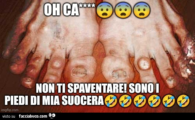 I piedi di mia suocera